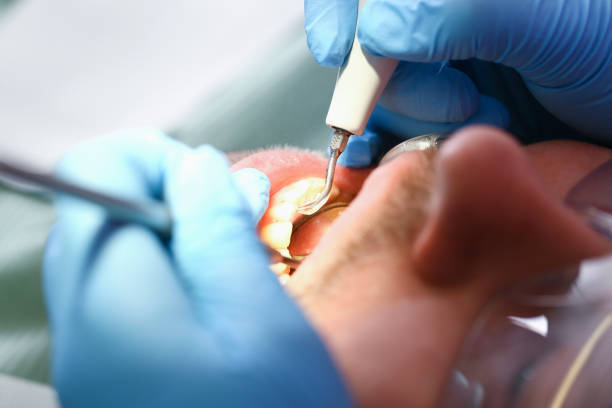 Best Holiday Emergency Dentist in Colma, CA